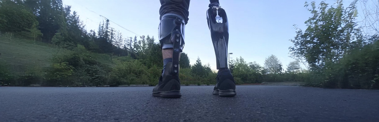 Limb Salvage and Neurorecovery Dynamic AFO