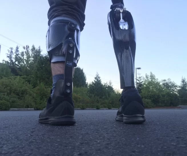 Limb Salvage and Neurorecovery Dynamic AFO