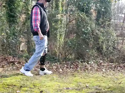 Limb Salvage Patient Walking