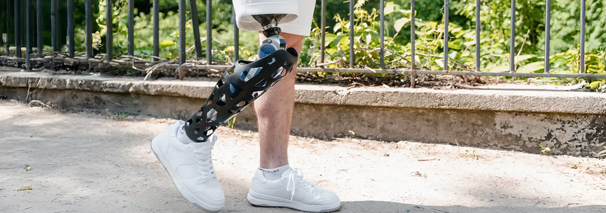 Lower Extremity Prosthetics