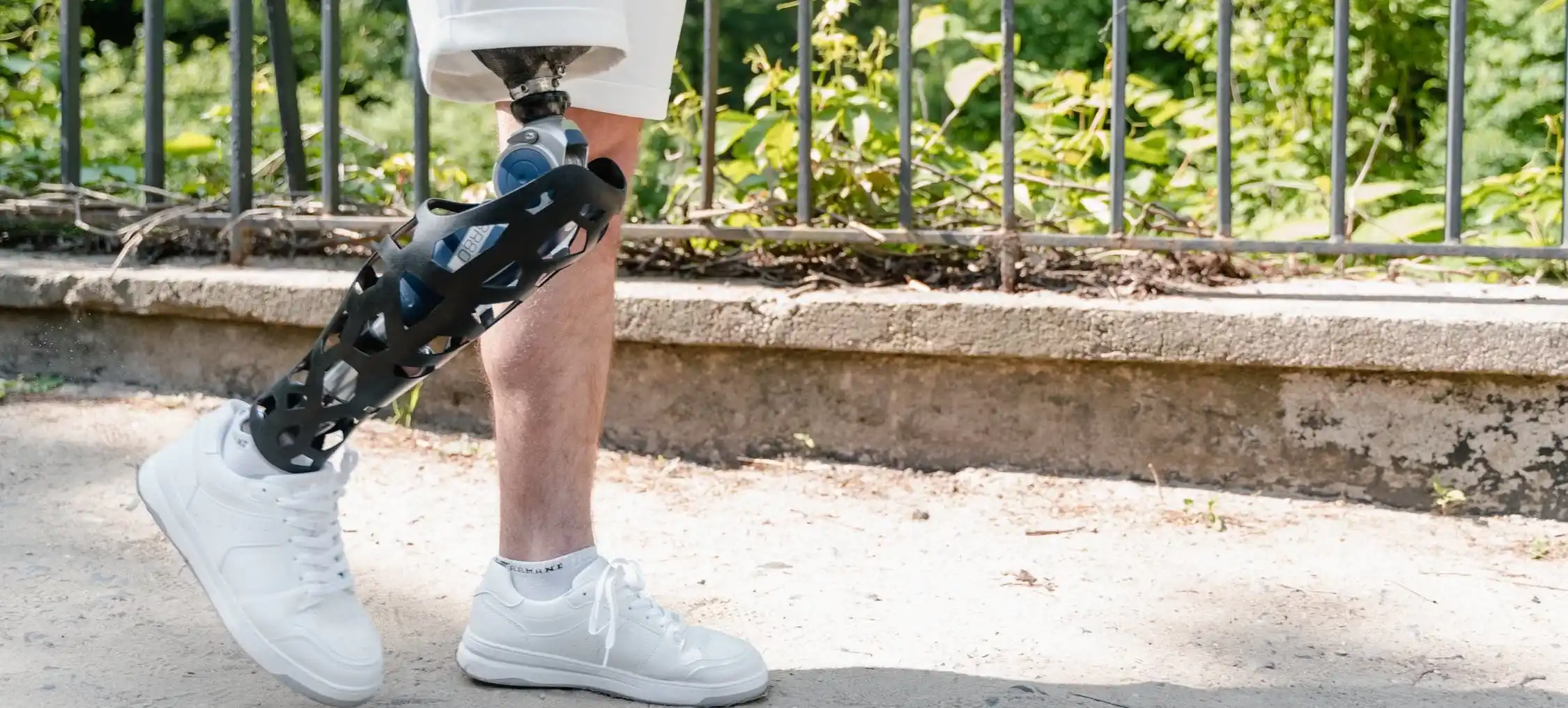 Lower Extremity Prosthetics