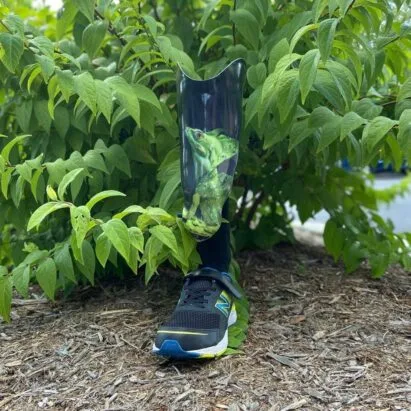 Custom Pediatric Prosthesis