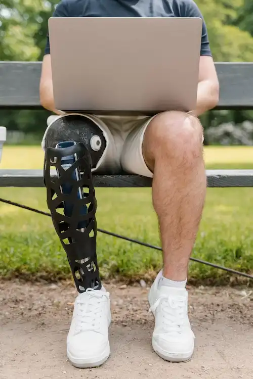 Upper & Lower Extremity Prosthetics