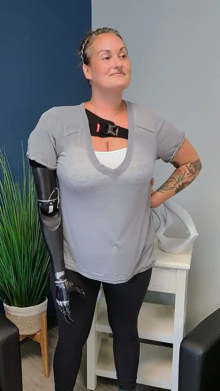 Upper extremity prosthetic patient